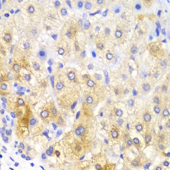 Immunohistochemistry - FASN Polyclonal Antibody (144-00461)