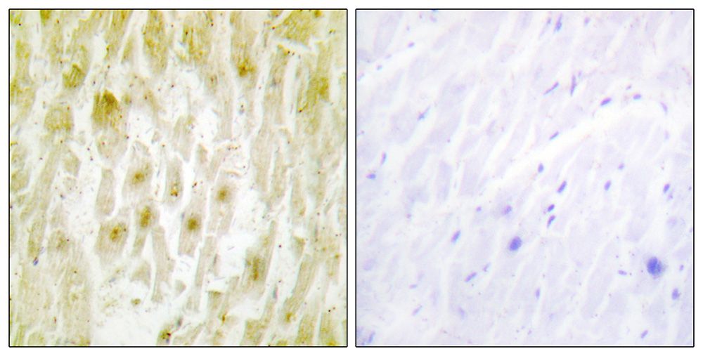 IHC