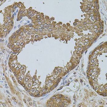 Immunohistochemistry - CHRFAM7A antibody (144-07844)