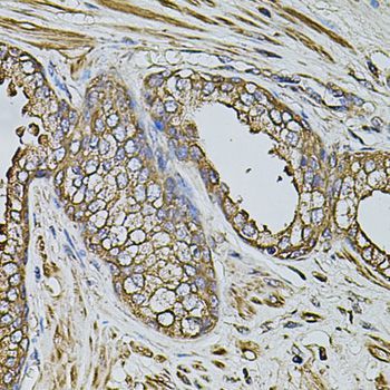 Immunohistochemistry - CPOX antibody (144-03807)