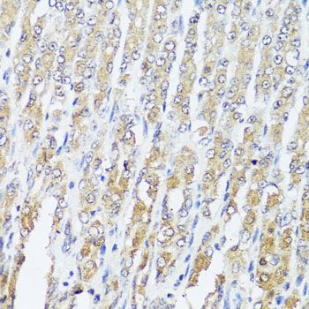 Immunohistochemistry - MCCC2 Polyclonal Antibody (144-07990)