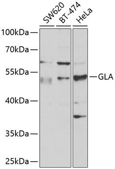 Western blot