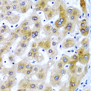 Immunohistochemistry - SECISBP2 Polyclonal Antibody (144-06736)