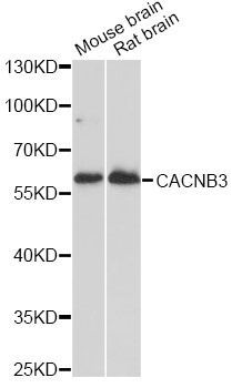Western blot - CACNB3 antibody (144-014710)
