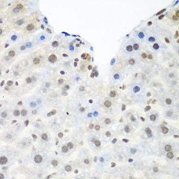Immunohistochemistry - TARDBP antibody (144-013405)