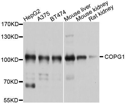 Western blot - COPG1 Polyclonal Antibody (144-10551)