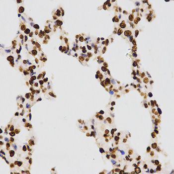 Immunohistochemistry - DiMethyl-Histone H3-K27 pAb (144-02362)