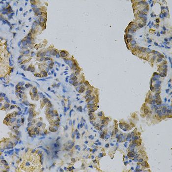 Immunohistochemistry - [KO Validated] GLUL Polyclonal Antibody (144-05437)