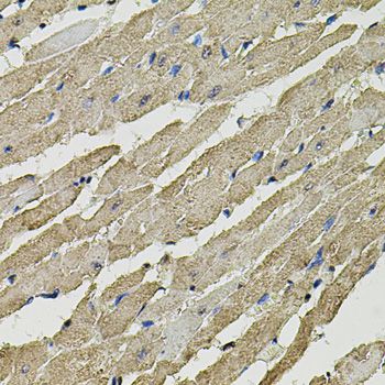 Immunohistochemistry - SMN2 Polyclonal Antibody (144-01652)