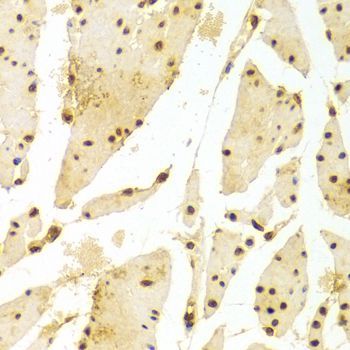 Immunohistochemistry - HIST2H2BE antibody (144-01958)