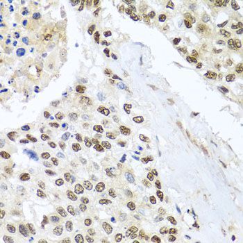 Immunohistochemistry - BNIP3L antibody (144-06283)