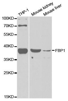 Western blot - FBP1 Polyclonal Antibody (144-05406)