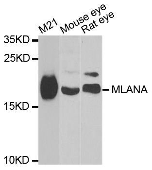 Western blot - MLANA Polyclonal Antibody (144-06290)