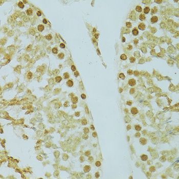 Immunohistochemistry - RCC1 Polyclonal Antibody (144-06350)