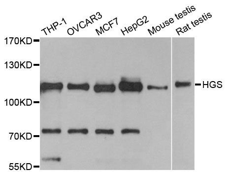 Western blot - HGS antibody (144-01790)