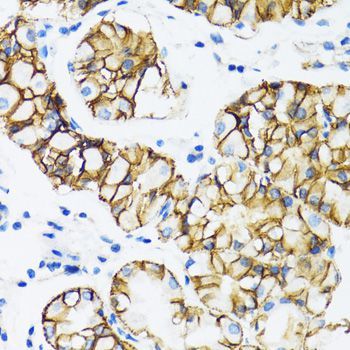 Immunohistochemistry - CTNNA1 Polyclonal Antibody (144-05635)