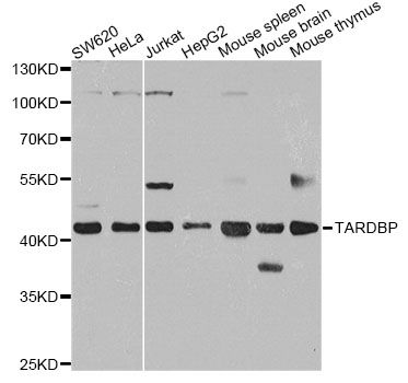 Western blot - TARDBP antibody (144-013405)