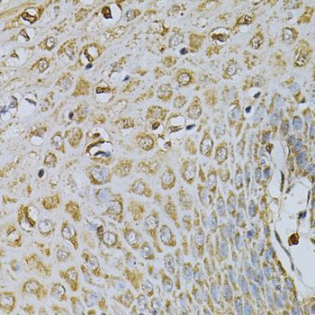 Immunohistochemistry - CDA Polyclonal Antibody (144-013959)