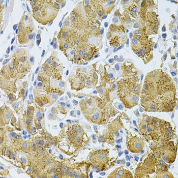 Immunohistochemistry - PLCG1 Antibody (144-07711)