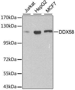 Western blot - DDX58 Polyclonal Antibody (144-00550)