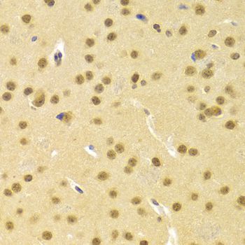 Immunohistochemistry - CBFB Antibody (144-05305)
