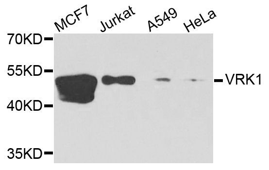 Western blot - VRK1 Polyclonal Antibody (144-07745)