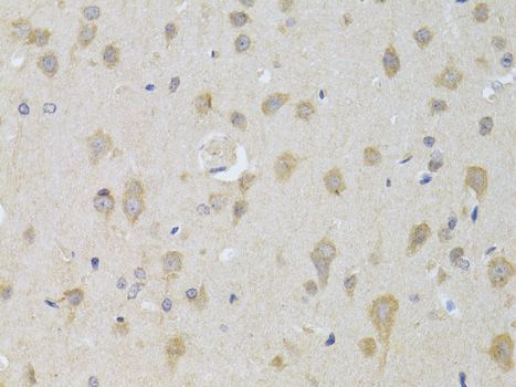 Immunohistochemistry - ATG13 Polyclonal Antibody (144-00690)