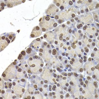 Immunohistochemistry - LMNB2 Polyclonal Antibody (144-06483)