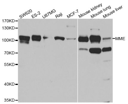 Western blot - MME antibody (144-05664)