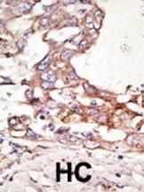 IHC-P