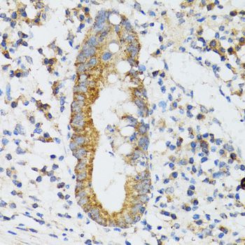 Immunohistochemistry - SRP19 Polyclonal Antibody (144-06752)