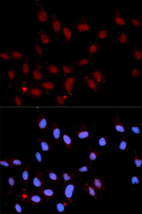 Immunohistochemistry - Phospho-Stat3-Y705 pAb (144-50070)