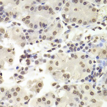 Immunohistochemistry - RUVBL1 Antibody (144-05723)