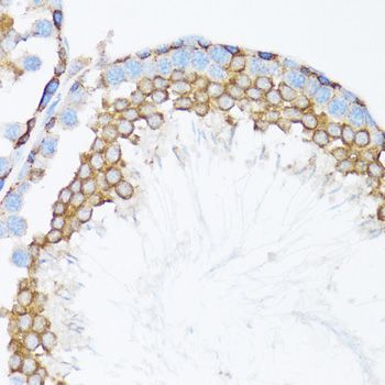 Immunohistochemistry - CTNNA1 Polyclonal Antibody (144-05635)