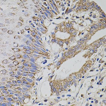 Immunohistochemistry - TRMT2A antibody (144-05975)