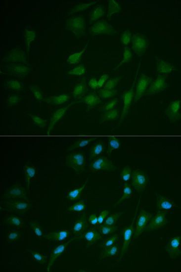 Immunofluorescence - LIG1 antibody (144-01858)