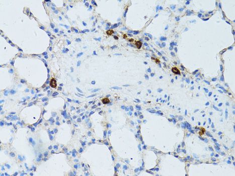 Immunohistochemistry - TEFM Polyclonal Antibody (144-08511)