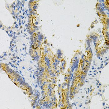 Immunohistochemistry - MYD88 Polyclonal Antibody (144-60032)