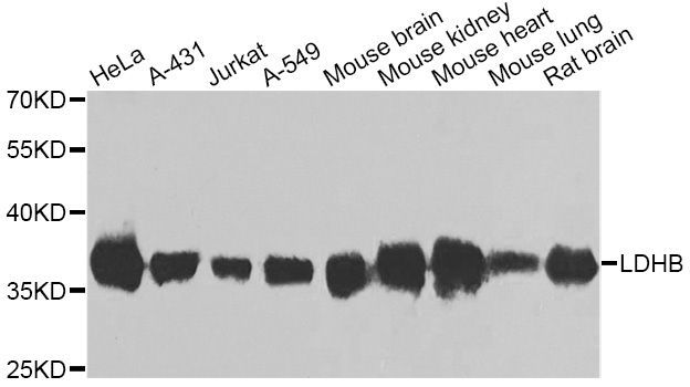 Western blot - LDHB antibody (144-07625)