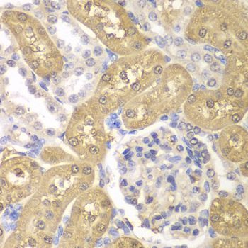 Immunohistochemistry - AKR1A1 antibody (144-60399)