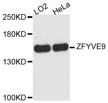 Western blot - ZFYVE9 antibody (144-09041)
