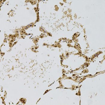 Immunohistochemistry - PLK4 antibody (144-09863)