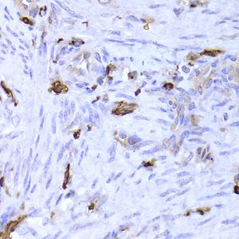 Immunohistochemistry - LSP1 Antibody (144-05617)