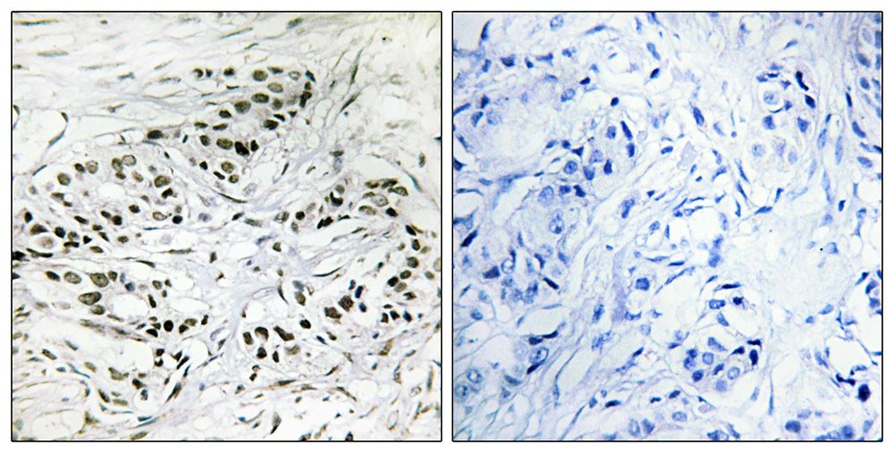 IHC