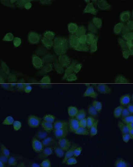 Immunofluorescence - ZFYVE9 antibody (144-09041)