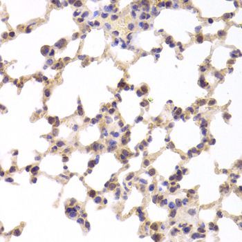 Immunohistochemistry - TSC22D3 Polyclonal Antibody (144-06779)