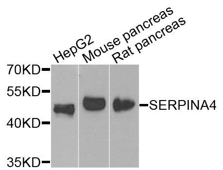 Western blot - SERPINA4 Polyclonal Antibody (144-07320)