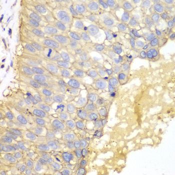 Immunohistochemistry - EPCAM Polyclonal Antibody (144-01177)