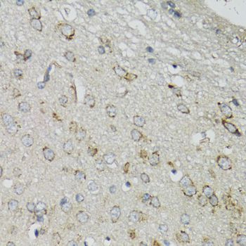 Immunohistochemistry - DGUOK antibody (144-06898)
