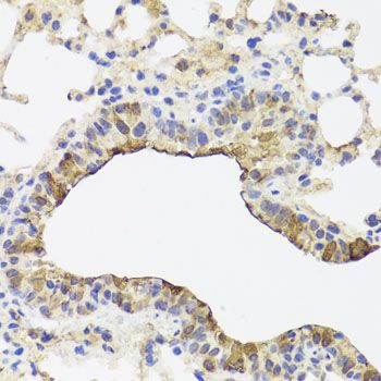 Immunohistochemistry - TOMM34 antibody (144-04467)